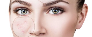 Pflege gegen Hautunreinheiten von Privateskinlab by RECOS Cosmetics